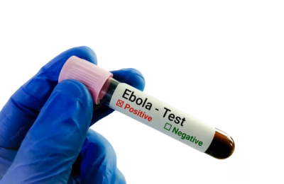 El Congo supera la barrera de los 10,000 casos de ébola y bordea los 5,000 muertos